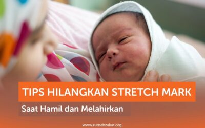 TIPS HILANGKAN STRETCH MARK SAAT HAMIL DAN MELAHIRKAN