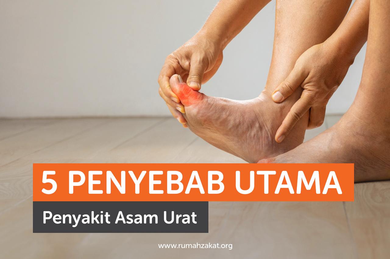 5 Penyebab Utama Penyakit Asam Urat 5 Penyebab Utama Penyakit Asam Urat